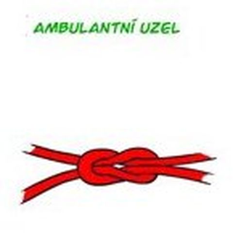 Ambulantní uzel